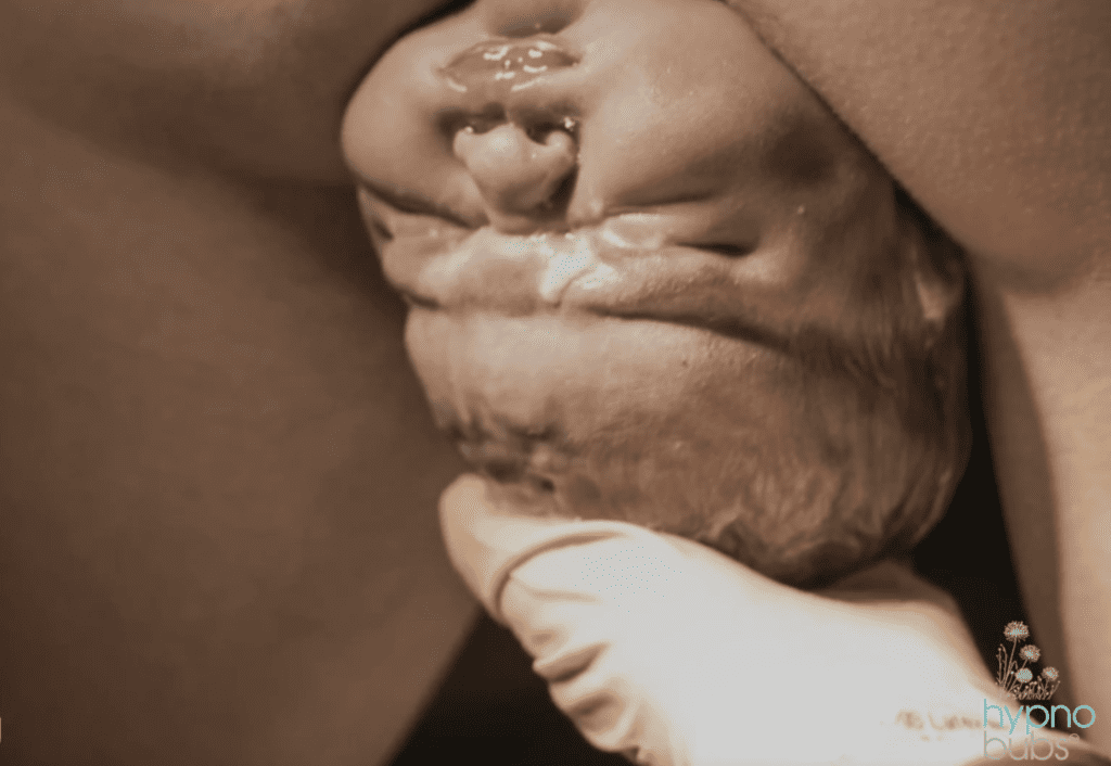 birth photography baby crowning natural birth hypnobirthing